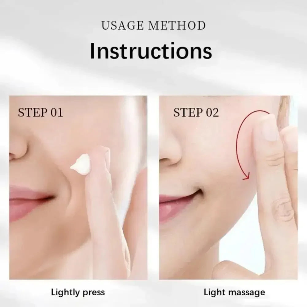 Whitening Freckles Face Cream Removal Melasma Dark Spots Corrector Lighten Melanin Pigmentation Brighten Anti-Aging Beauty Care