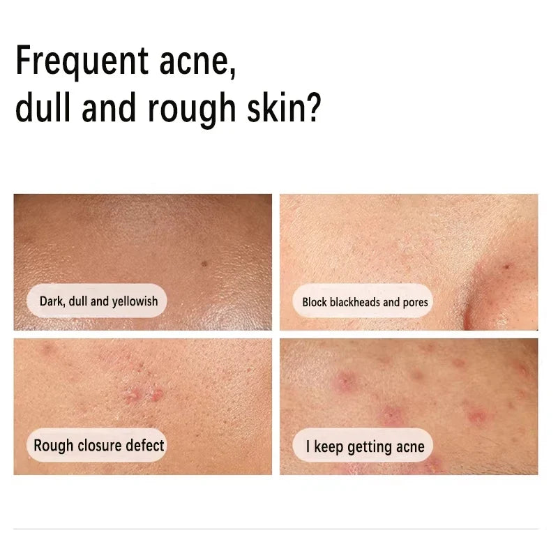Glow & Clear Skin Serum